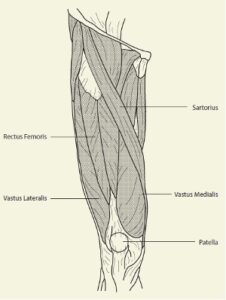 Quadriceps Contusion (Cork Thigh) | Sports Medicine Australia